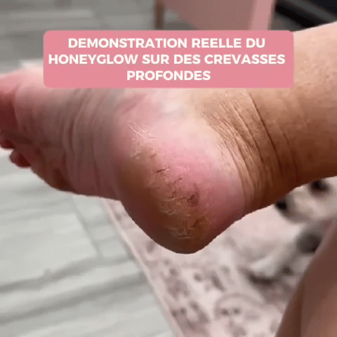 HoneyGlow™ - Voetverzorgingskit